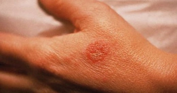 Eldeki Egzamaya Ne İyi Gelir?